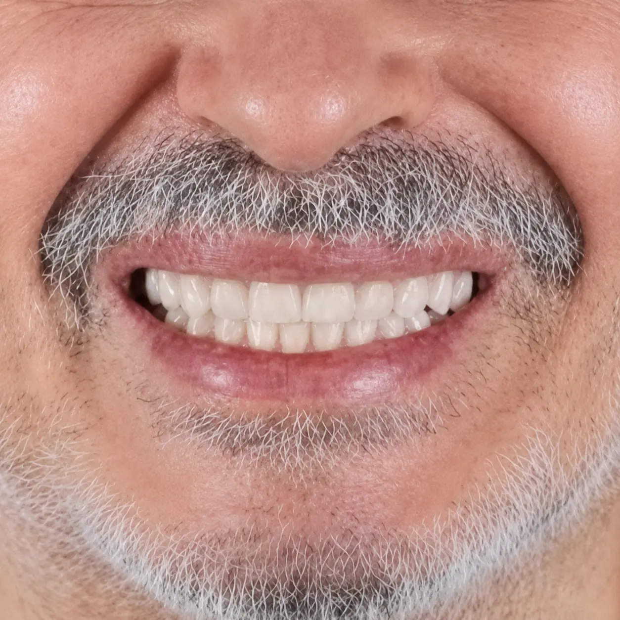 Depois